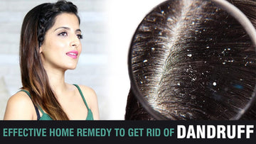 Effective Home Remedy To Get Rid of Dandruff