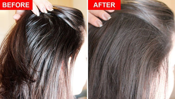 Effective Tips To Get Rid of Oily Scalp 2024