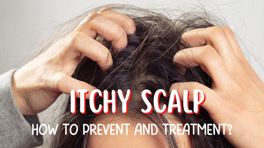 Itchy Scalp: How To Prevent & Treatment?