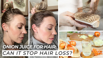 Onion Juice For Hair: Can It Stop Hair Loss?
